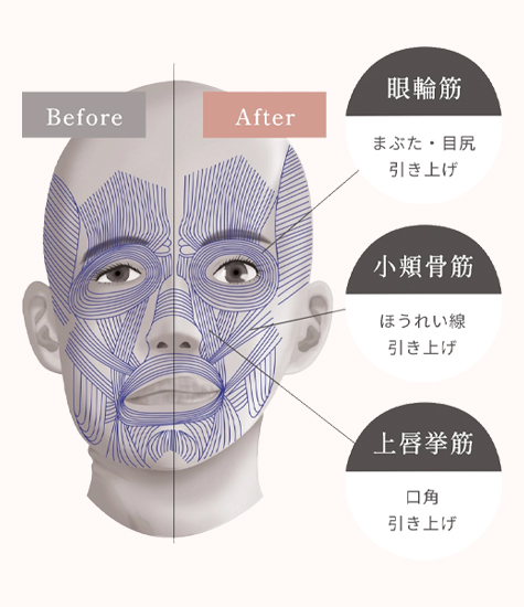 タルミの原因「表情筋」にアプローチ