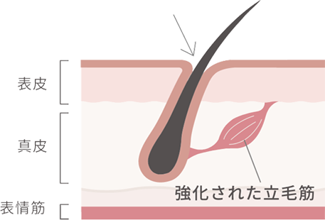 筋力が強化された立毛筋