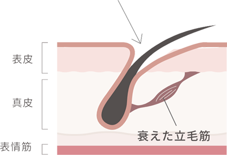 筋力が衰えた立毛筋